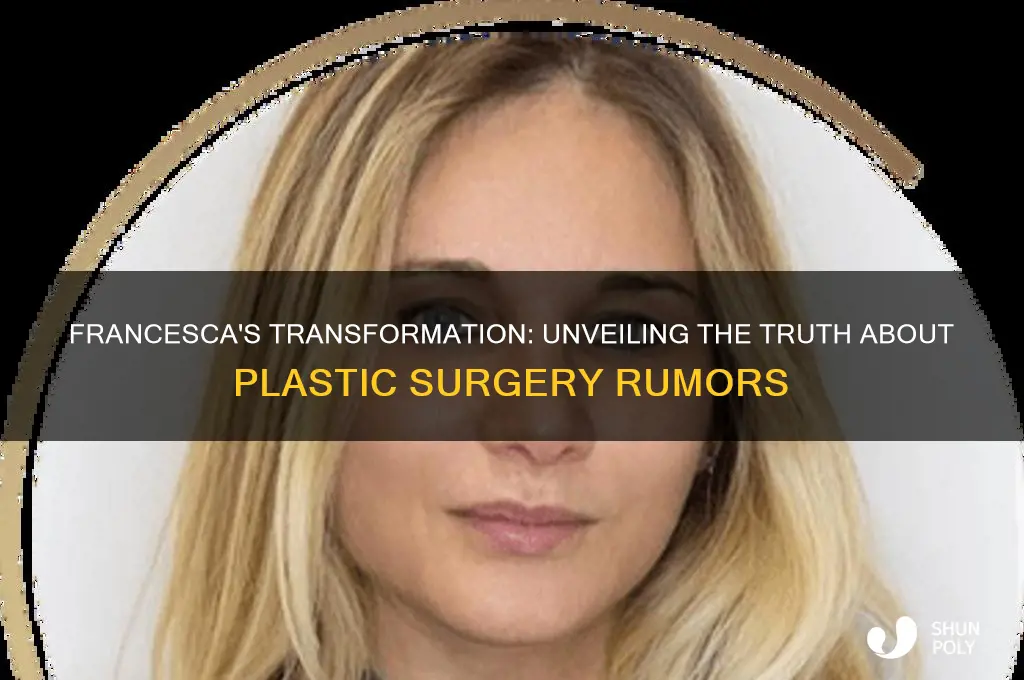 does francesca have plastic surgery