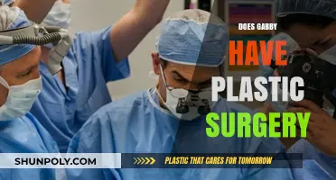 Did Gabby Undergo Plastic Surgery? Unveiling the Truth Behind Her Look
