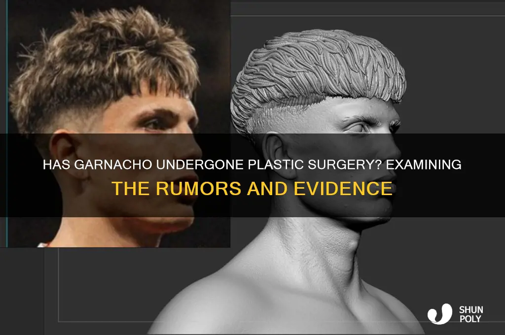 does garnacho have plastic surgery