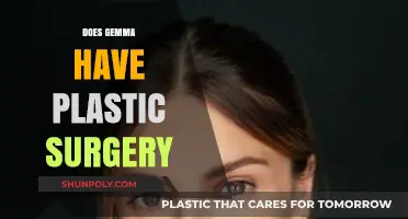 Gemma's Transformation: Plastic Surgery Speculations and Truths Revealed