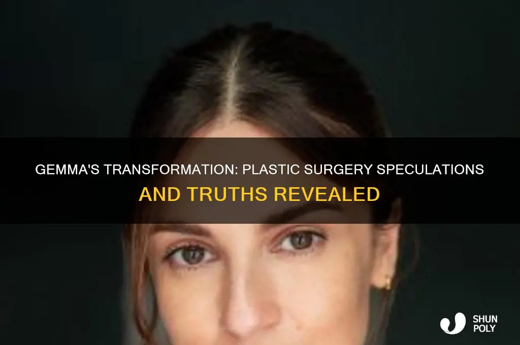 does gemma have plastic surgery