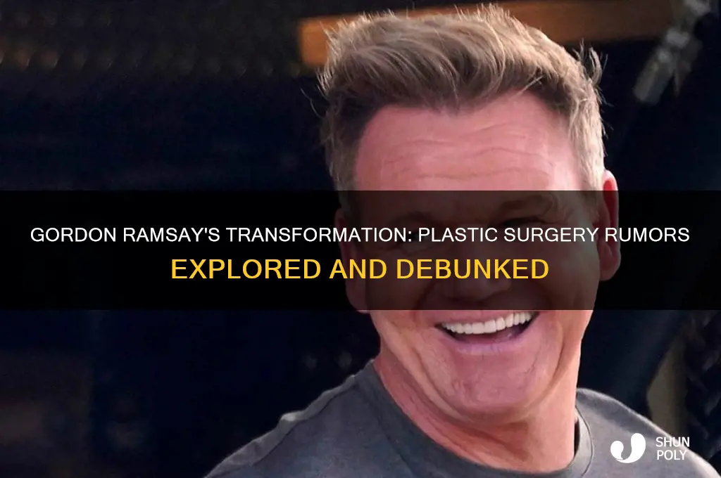does gordon ramsay have plastic surgery