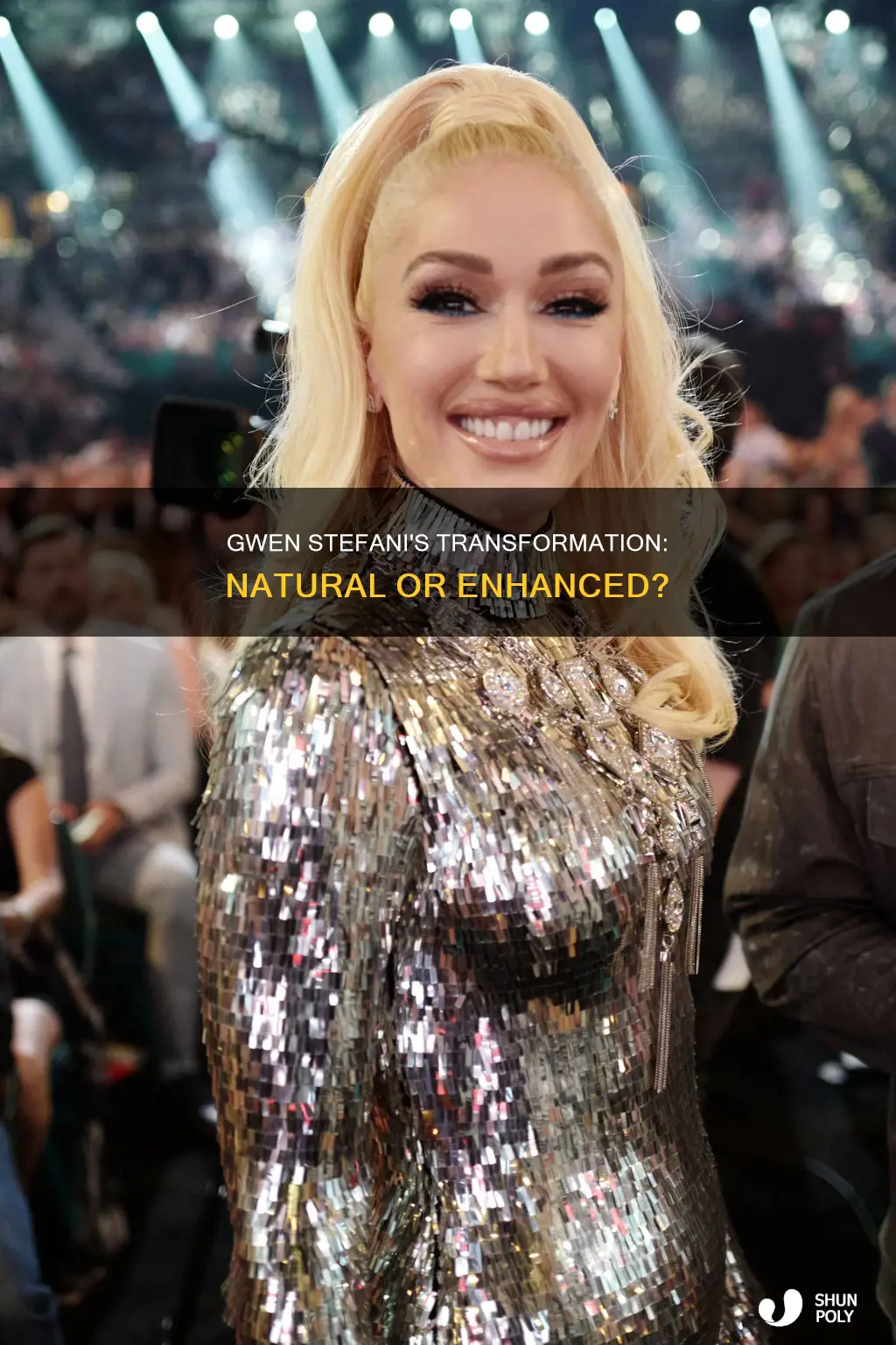 does gwen stefani have plastic surger