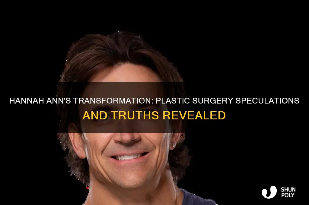 does hannah ann have plastic surgery