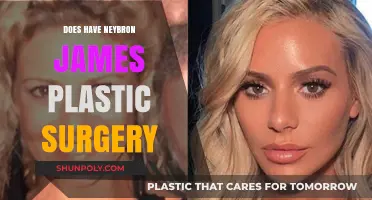 Has LeBron James Had Plastic Surgery? Examining the Rumors and Evidence
