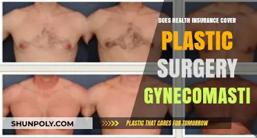 Does Health Insurance Cover Gynecomastia Plastic Surgery? What to Know