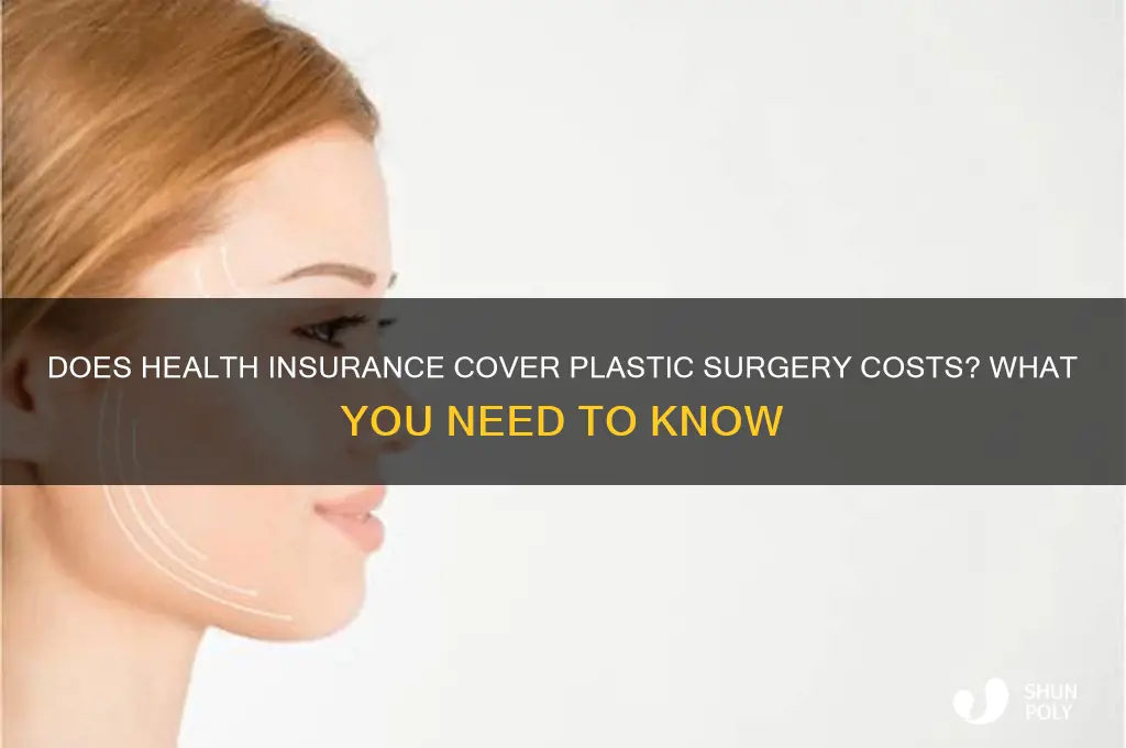 does health insurance pay for plastic surgery
