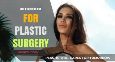 Does Hooters Cover Employee Plastic Surgery Costs? The Truth Revealed