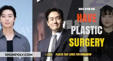 Hyun Bin's Transformation: Plastic Surgery Rumors Explored and Debunked
