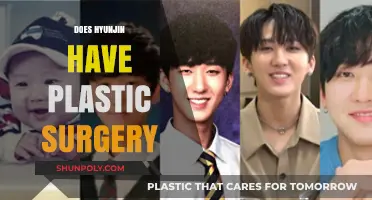 Hyunjin's Transformation: Unveiling the Truth About Plastic Surgery Rumors