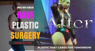 Iggy Azalea's Transformation: Plastic Surgery Rumors and Reality Explored