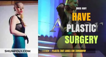 Did Iggy Azalea Undergo Plastic Surgery? Uncovering the Truth and Rumors