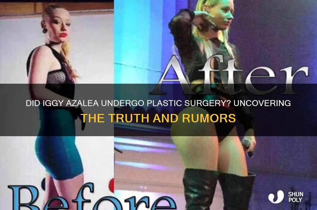 does iggy have plastic surgery