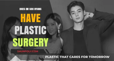 Im Soo Hyang Plastic Surgery: Fact-Checking the Rumors and Speculations