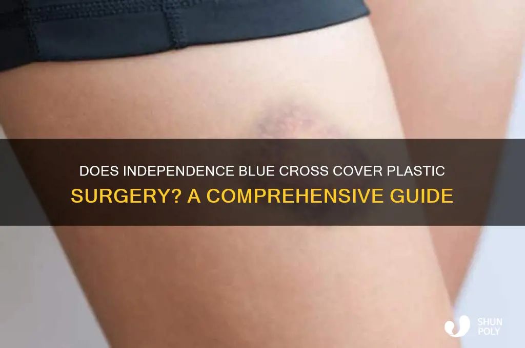 does independence blue cross cover plastic surgery