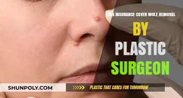 Does Insurance Cover Mole Removal by a Plastic Surgeon?