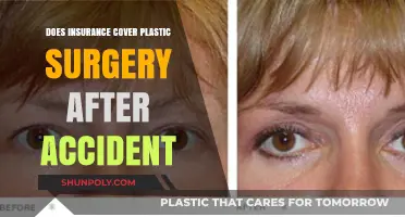 Does Insurance Cover Plastic Surgery Post-Accident? What You Need to Know