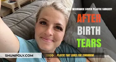 Does Insurance Cover Plastic Surgery for Postpartum Birth Tears?