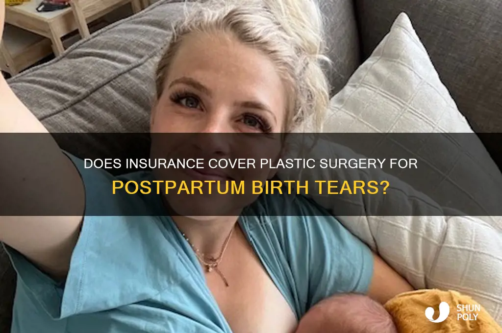 does insurance cover plastic surgery after birth tears