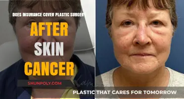 Does Insurance Cover Plastic Surgery Post-Skin Cancer Treatment?