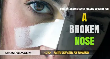 Does Insurance Cover Plastic Surgery for a Broken Nose?