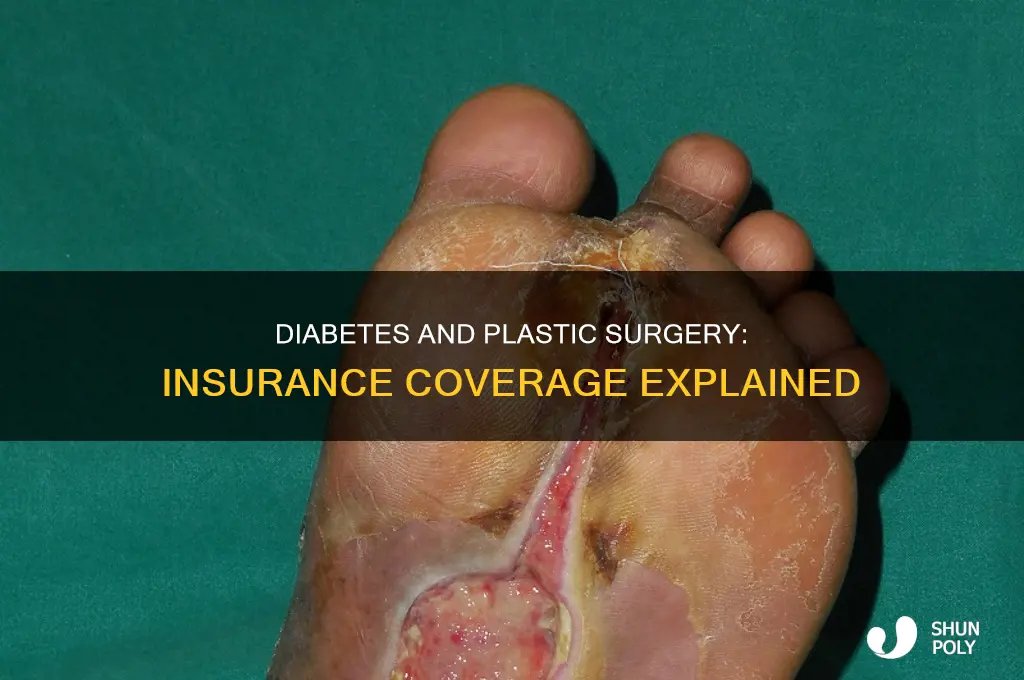 does insurance cover plastic surgery for people with diabetes