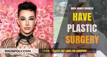 James Charles Plastic Surgery: Fact-Checking the Beauty Guru's Transformation