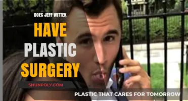 Jeff Wittek Plastic Surgery: Uncovering the Truth Behind His Transformation