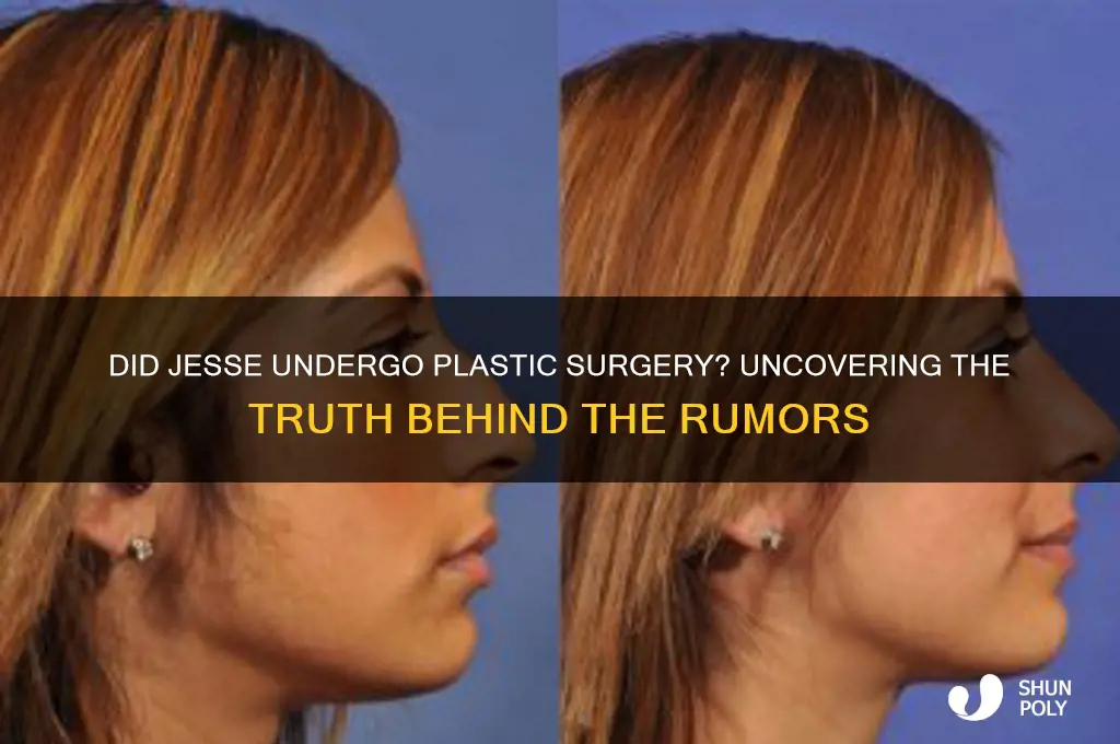 does jesse get plastic surgery