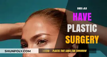 JLo's Transformation: Unveiling the Truth About Plastic Surgery Rumors