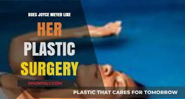 Joyce Meyer's Plastic Surgery: Her Thoughts and Public Perception