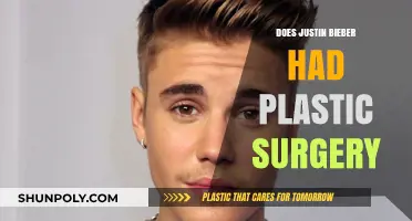 Justin Bieber's Transformation: Plastic Surgery Rumors Explored