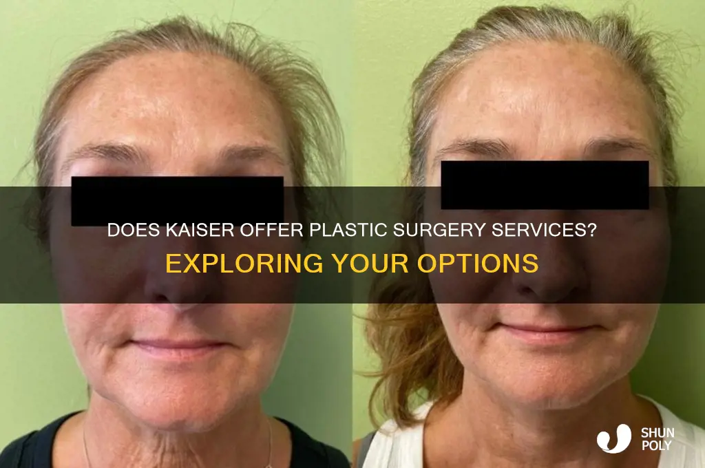 does kaiser have plastic surgeons