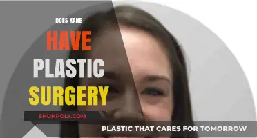 Did Kane Undergo Plastic Surgery? Uncovering the Truth Behind the Rumors