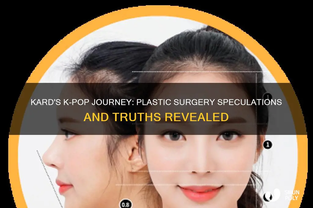 does kard kpop have plastic surgery