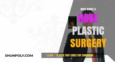 Karol G's Transformation: Plastic Surgery Rumors and Reality Revealed