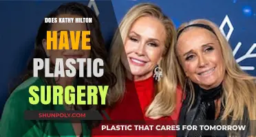 Kathy Hilton's Transformation: Plastic Surgery Rumors and Reality Revealed
