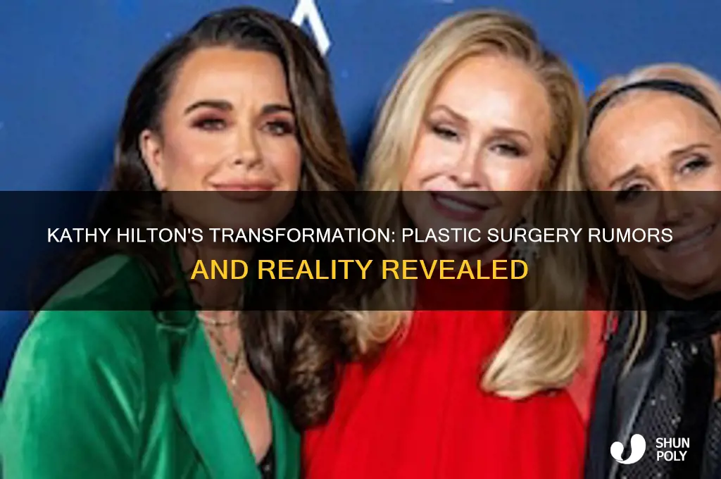 does kathy hilton have plastic surgery