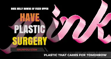 Kelly Downs Fixer Upper: Plastic Surgery Speculations Explored