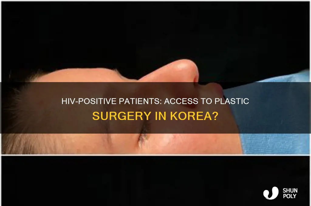 does korea