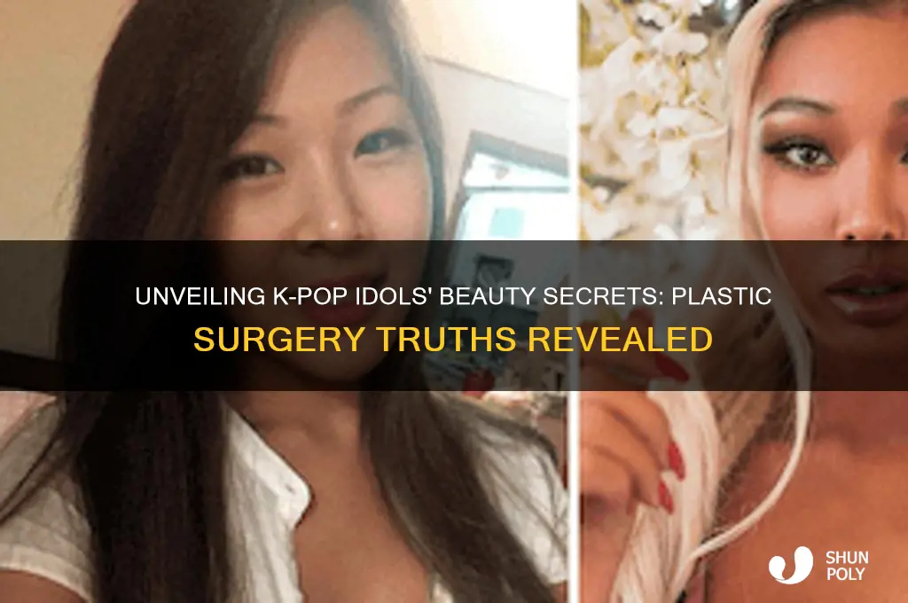 does kpop idols do plastic surgery