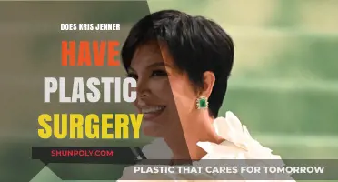 Kris Jenner's Transformation: Plastic Surgery Speculations and Truths Revealed
