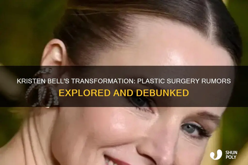 does kristen bell have plastic surgery