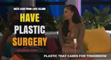 Leah Love Island Plastic Surgery: Fact-Checking the Transformation Rumors