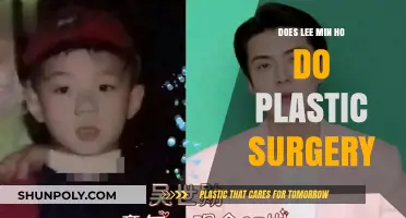 Lee Min Ho's Transformation: Plastic Surgery Rumors Explored