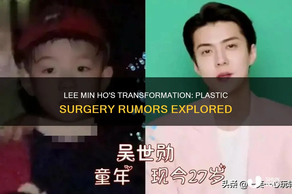 does lee min ho do plastic surgery