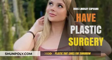 Lindsay Capuano's Transformation: Plastic Surgery Speculations and Truths