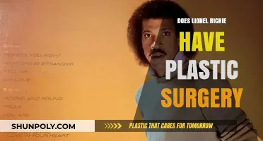Lionel Richie's Transformation: Plastic Surgery Rumors and Reality Revealed