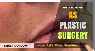 Is Lip Filler Considered Plastic Surgery? Exploring the Debate