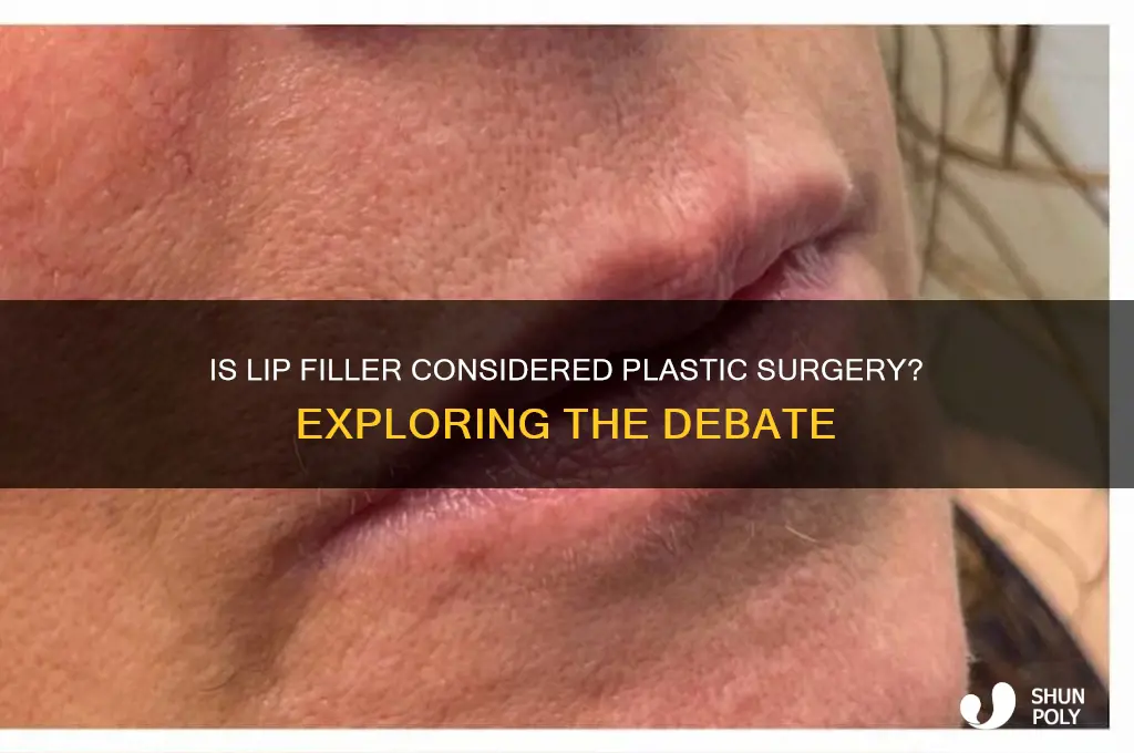 does lip filler count as plastic surgery